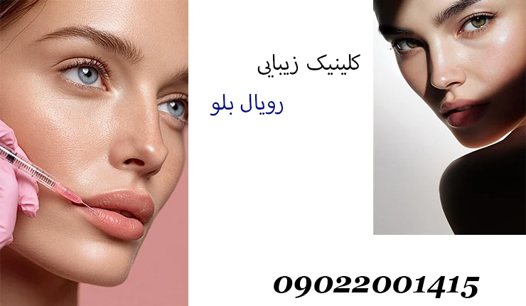 تزریق ژل لب در تهران