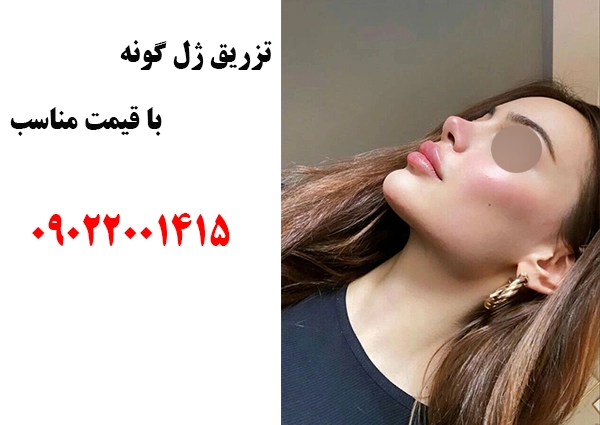 تزریق ژل گونه نمونه کار