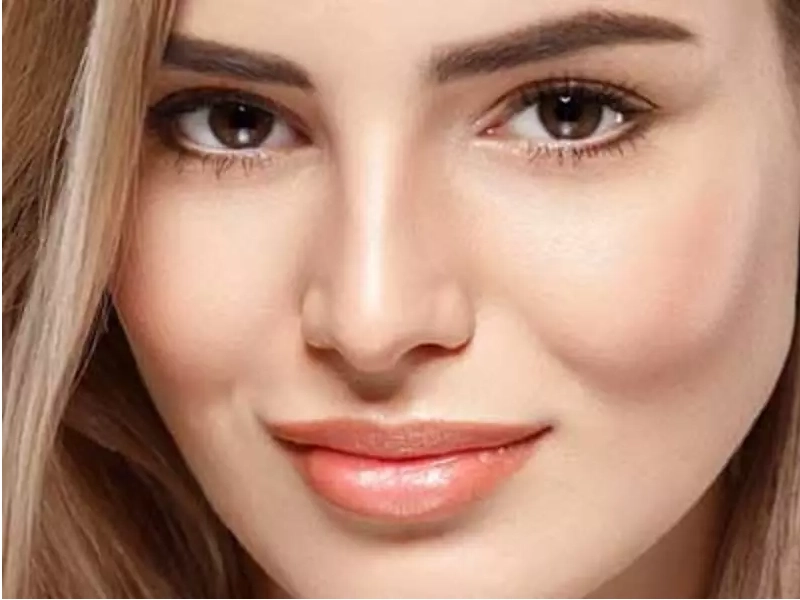 تزریق فیلر گونه