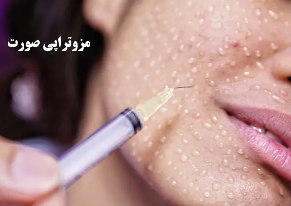 مزوتراپی صورت