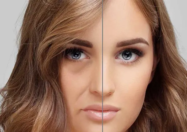 تفاوت میدفیس و ژل گونه