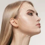 فرق ژل گونه با ژل میدفیس
