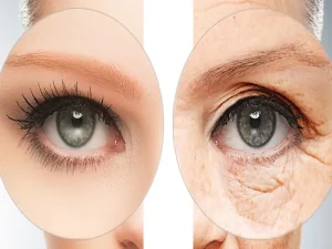 پلاسماجت صورت