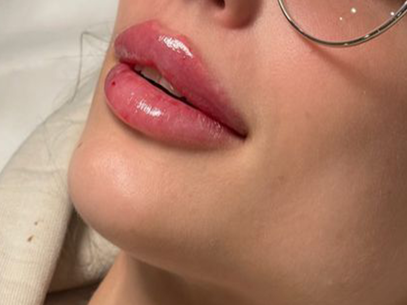 مدل لب روسی