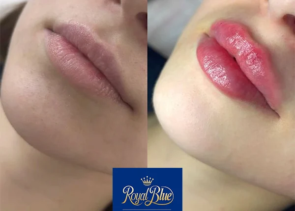 نمونه کار ژل لب روسی