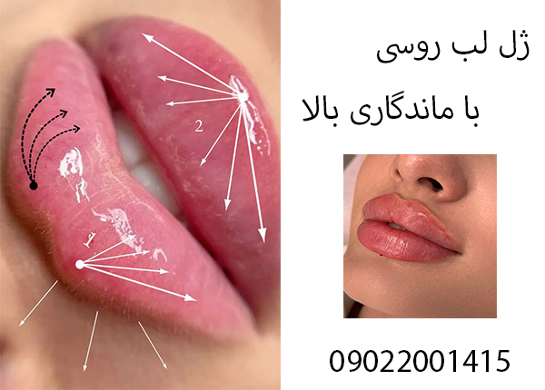 ژل لب روسی ارزان