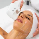 توصیه های بعد از هایفوتراپی