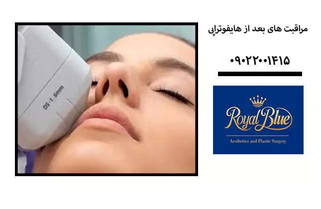 مراقبت های بعد از هایفوتراپی