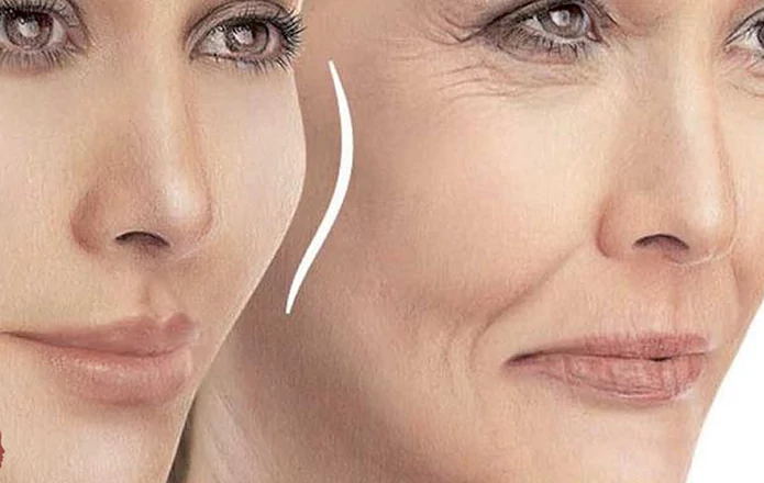 تزریق پروفایلو