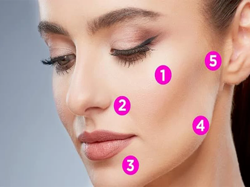 نقاط تزریق پروفایلو