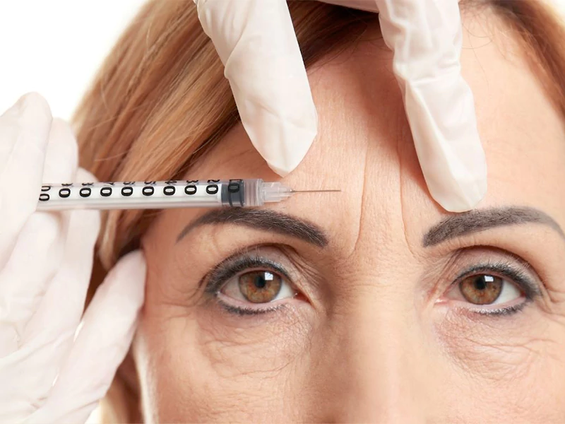 بوتاکس پیشانی شرق تهران