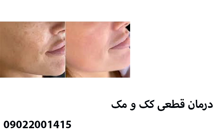 قاتل کک و مک