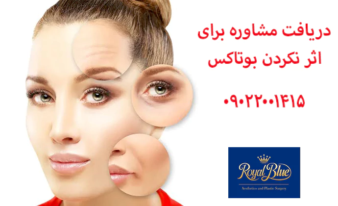 اثر نکردن بوتاکس